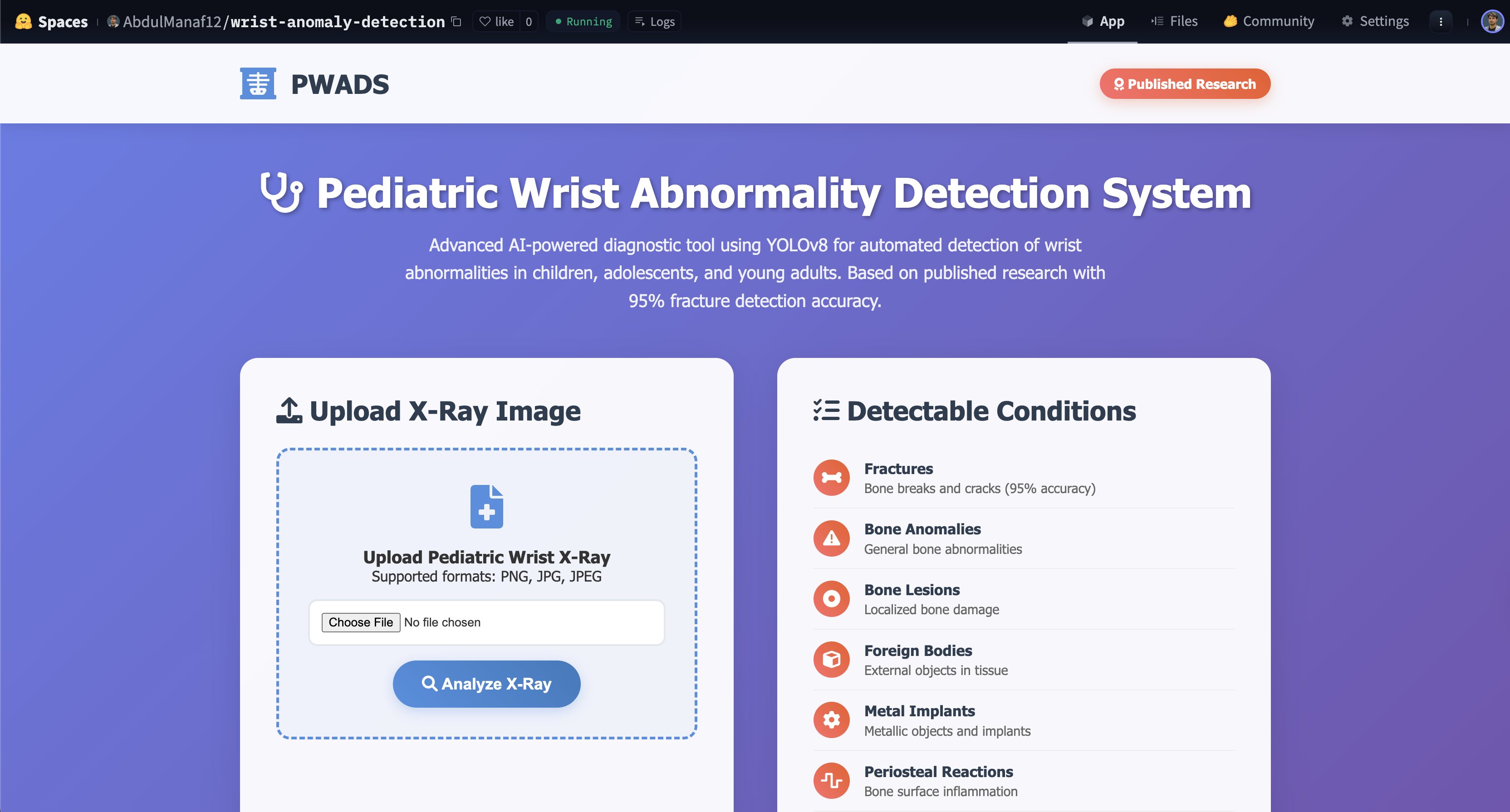 Wrist Detection
